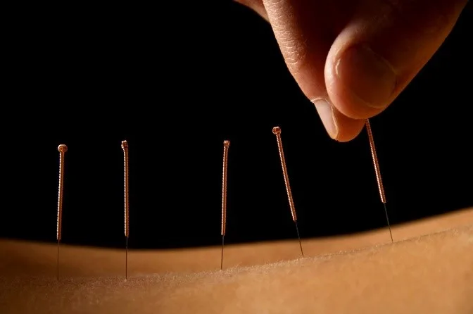 What is acupuncture - Therapeutic Kneads